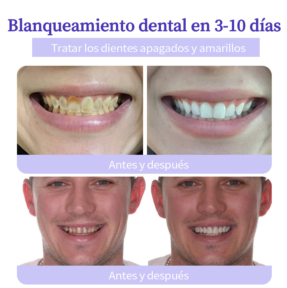 ✨✨GarageLine™ (recomendado por la ADA) Polvo Mineral para la Restauración Dental (⏰Oferta por tiempo limitado, últimos 30 minutos⏰) 🪥🦷