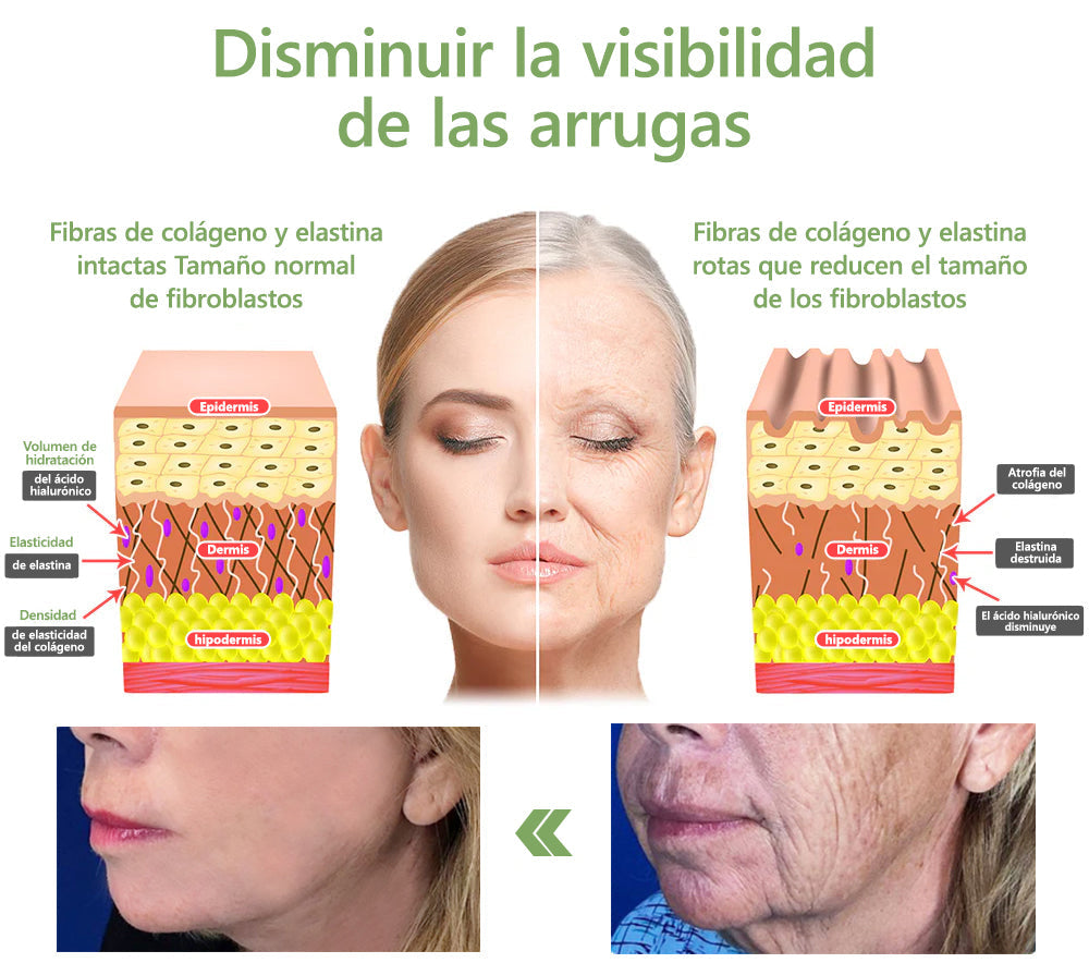 Fubsta™ SUERO FACIAL DE ÁCIDO HIALURÓNICO🚀 (🔥70% Off for a Limited Time )