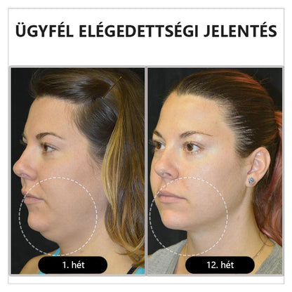 A nők potenciáljának felszabadítása ❤️‍🔥CZTICLE™ Histone Magnetology Lymphvity Germanium Fülbevaló (🔥Akció utolsó napja 80% kedvezmény🔥)