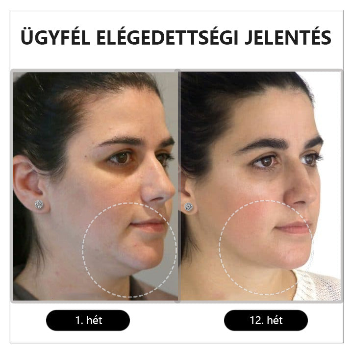 A nők potenciáljának felszabadítása ❤️‍🔥CZTICLE™ Histone Magnetology Lymphvity Germanium Fülbevaló (🔥Akció utolsó napja 80% kedvezmény🔥)