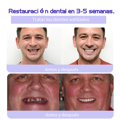 ✨✨GarageLine™ (recomendado por la ADA) Polvo Mineral para la Restauración Dental (⏰Oferta por tiempo limitado, últimos 30 minutos⏰) 🪥🦷