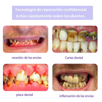 ✨✨GarageLine™ (recomendado por la ADA) Polvo Mineral para la Restauración Dental (⏰Oferta por tiempo limitado, últimos 30 minutos⏰) 🪥🦷