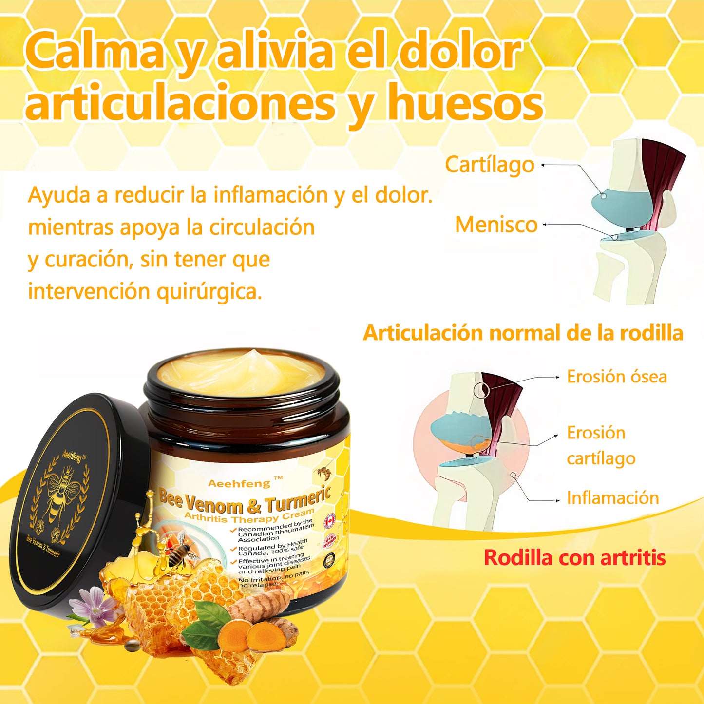 🐝🐝Aeehfeng™ Crema para el tratamiento de la artritis con veneno de abeja y cúrcuma, especializada en afecciones ortopédicas y dolores articulares